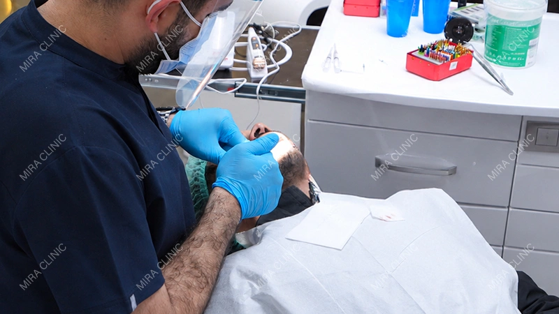Dental Implant Treatment